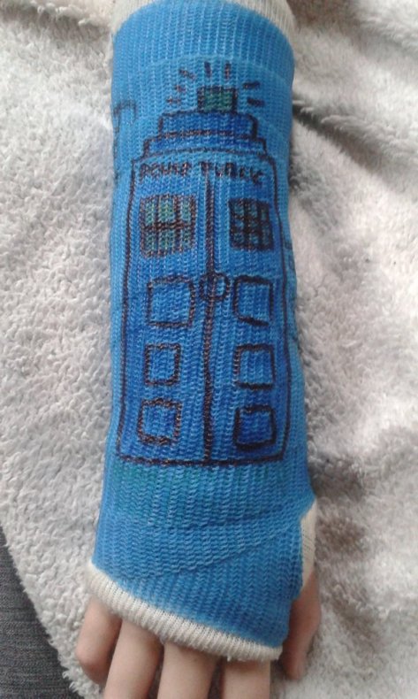 Ouch! My TARDIS cast